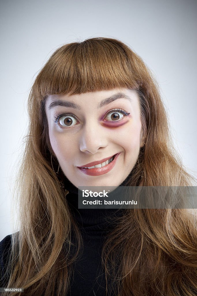 Funny Girl Beaten Up Stock Photo - Download Image Now - Black Eye, Women,  Bruise - iStock