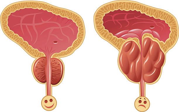 illustrations, cliparts, dessins animés et icônes de homme prostate - prostate gland