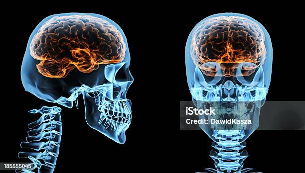 Gehirn Im Schädel Stockfoto und mehr Bilder von 3-D-Scanning - 3-D-Scanning, Anatomie, Arthritis