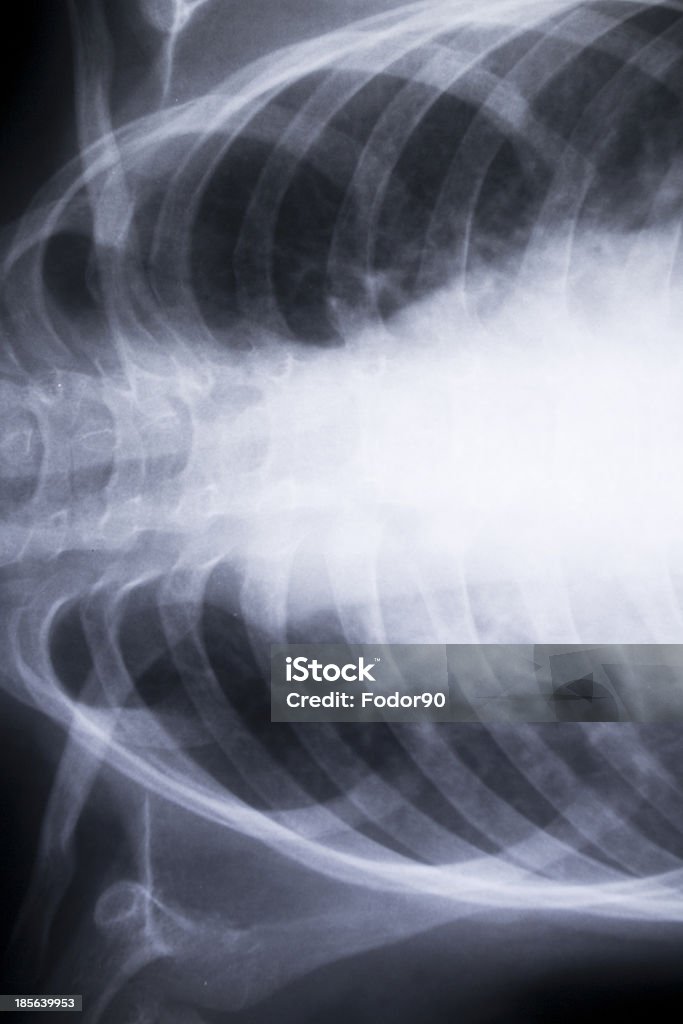 x-ray chest Agricultural Field Stock Photo