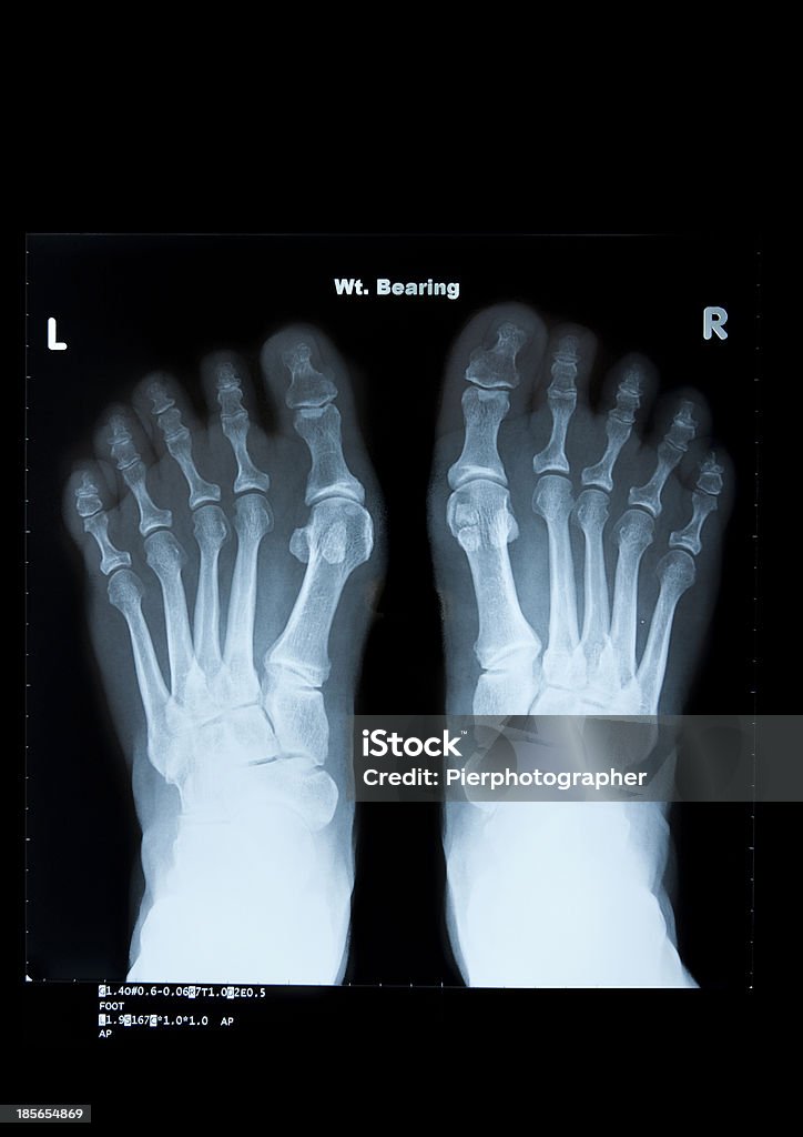 Exámenes médico - Foto de stock de Imagen de rayos X libre de derechos