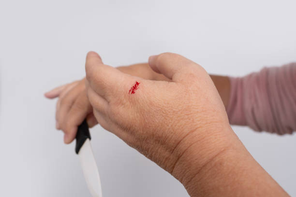 赤い血の滴、女性の手のクローズアップ、切り傷、磁器の刃で包丁、概念家庭内傷害、家庭内事故 - wound blood human finger physical injury ストックフォトと画像