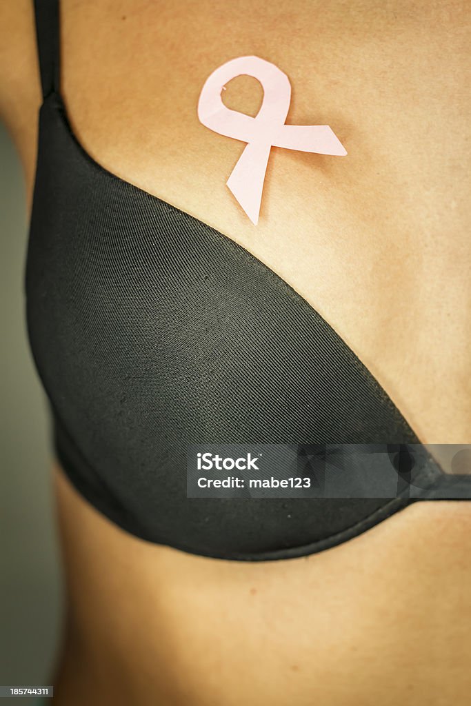 Carcinoma mammario - Foto stock royalty-free di Donne