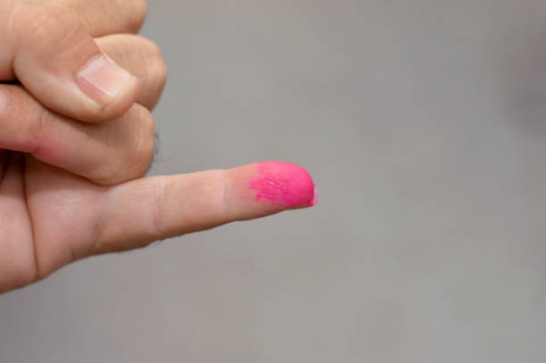 Election ink, indelible phosphoric ink or electoral stain, a semi-permanent ink or dye that is applied to the forefinger of voters during elections to prevent electoral fraud such as double voting, selective focus