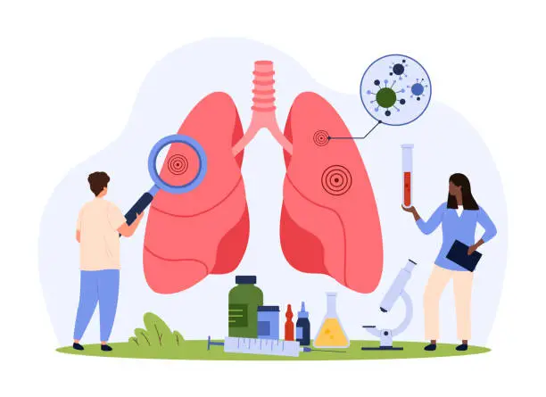 Vector illustration of Diagnostics of lung disease, pulmonology, tiny people check lungs with magnifying glass