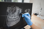 Dental consultation in clinic. 3D tomography.