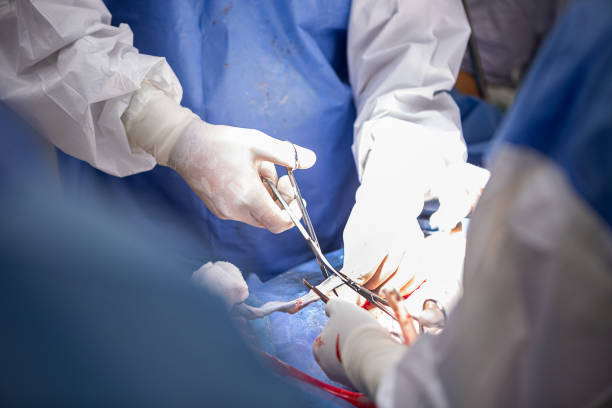 Doctors performing a cesarean section in the operating room stock photo