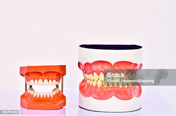 Par De Dientes Humanos Modelos De Plástico Foto de stock y más banco de imágenes de Anatomía - Anatomía, Carie dental, Clínica médica