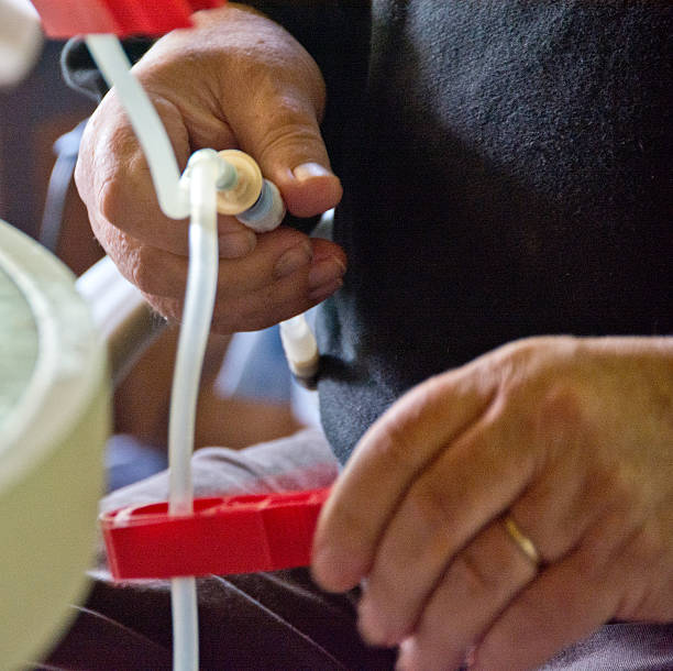 Adjusting clamps for peritoneal dialysis treatment A man hooks himself up to tubing for peritoneal dialysis. peritoneal dialysis stock pictures, royalty-free photos & images
