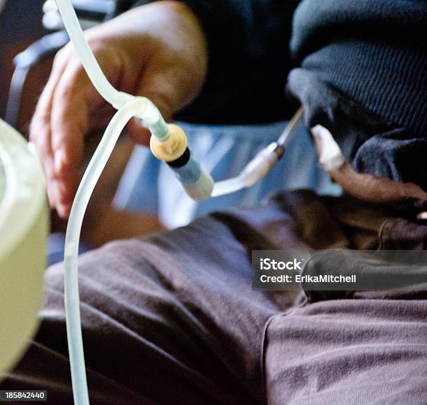 Male Patient Doing Peritoneal Dialysis Treatment Stock Photo - Download Image Now - Dialysis, Peritoneal Dialysis, Residential Building