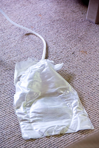 Waste bag for peritoneal dialysis treatment This bag is used to collect the waste fluids during peritoneal dialysis. peritoneal dialysis photos stock pictures, royalty-free photos & images