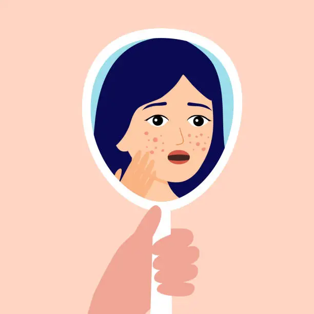 Vector illustration of Young woman hand mirror worrying about her acne on face in flat design. Pimple problem on female skin.