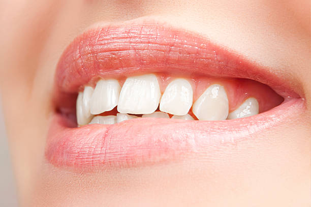 istock Teeth of a smiling young woman 185912617