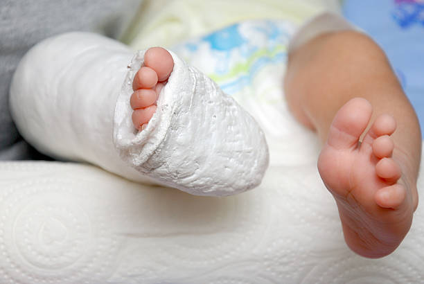 bayi kaki dalam perban dan pemeran - patah tulang cedera potret stok, foto, & gambar bebas royalti