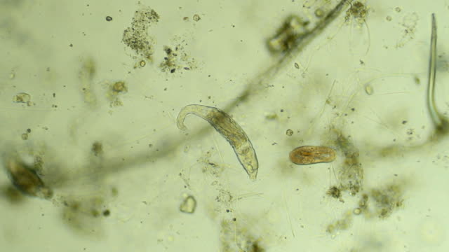 Two micro organisms - zoom in