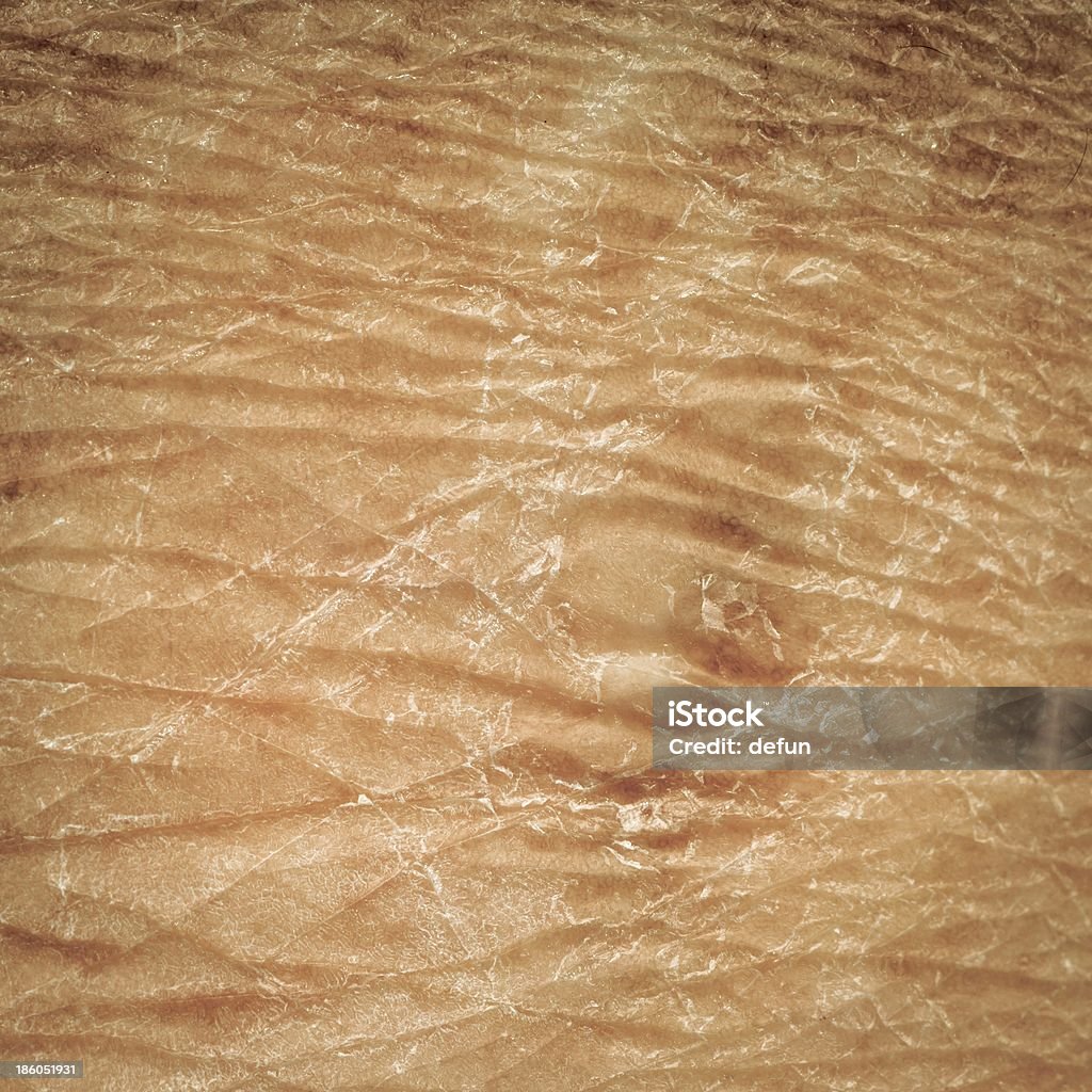 La texture de la peau au sec - Photo de Abstrait libre de droits