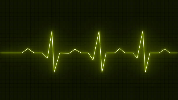 istock Heart beat icon ekg and cardio symbol. .Pulse rate vector. Flat style vector illustration. Neon heartrate sign with yellow glows 1861184499