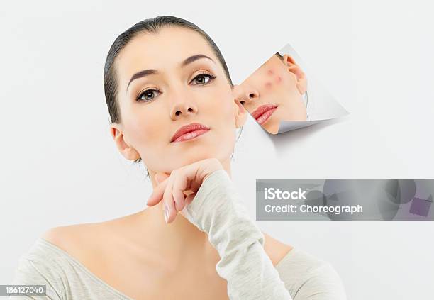 Beauty Portrait Stock Photo - Download Image Now - Acne, Human Face, 20-29 Years