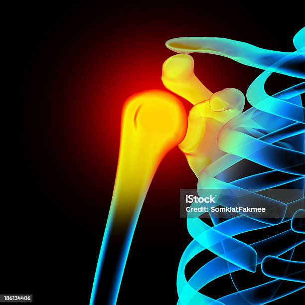 肩と肩甲骨鎖骨 - X線撮影のストックフォトや画像を多数ご用意 - X線撮影, スクエア, ヒトのアゴの骨