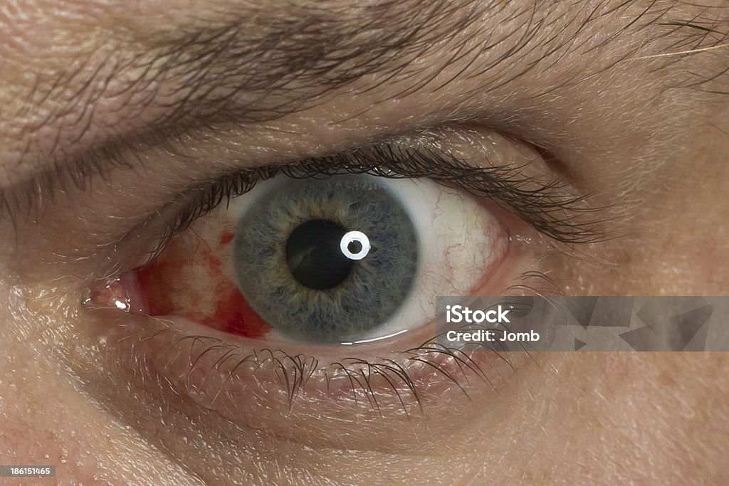 Extreme close-up di occhi rossi - Foto stock royalty-free di Insonnia