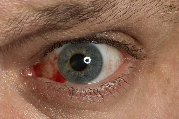 istock Extreme close up on red eye 186151465