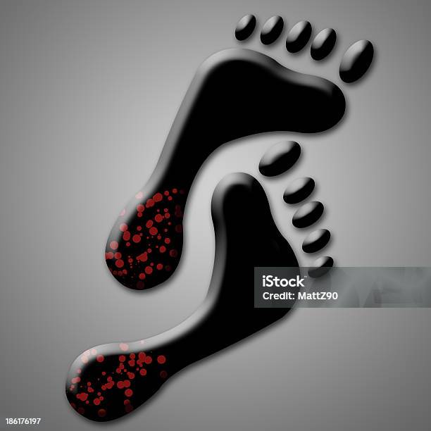 Illustration Relating Feet Skin Problems As Mycosis Or Dry Heels Stock Photo - Download Image Now