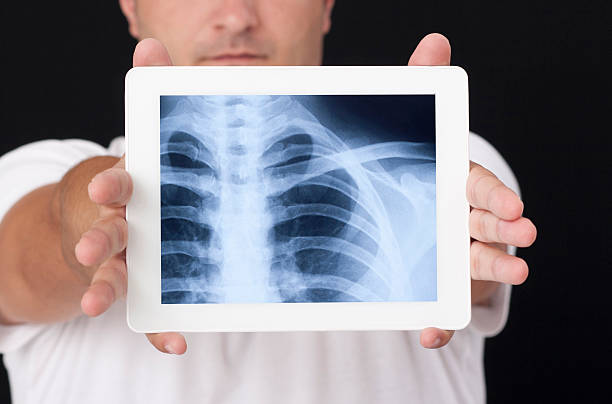 x-ray auf der digital tablet - libs stock-fotos und bilder