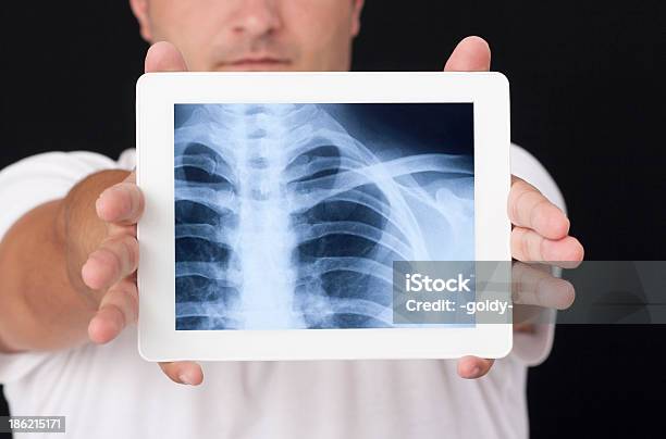 Xray Na Tablet - zdjęcia stockowe i więcej obrazów Anatomia człowieka - Anatomia człowieka, Biodro, Brzuch