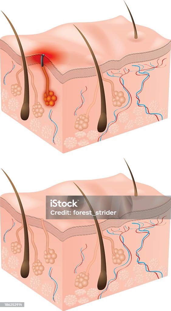 Menschliche Haut Struktur - Lizenzfrei Anatomie Vektorgrafik