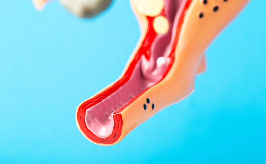 Mockup of the female reproductive system of the vagina on a blue background. Concept of diseases and infections of the vagina, chlamydia and ureaplasmosis, bacterial vaginosis. Maintaining hygiene of intimate areas.