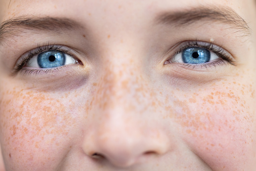 Close-up photo. Body part. Young happy and joyful face in freckles, blue eyes of a child, teenager, looking at the camera.
