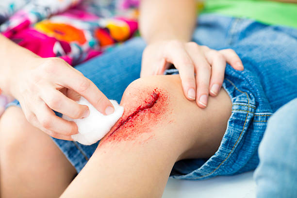 Mother Cleaning sons Wound. Mother Cleaning sons scraped knee after playing soccer. Selective focus to wound. Unrecognizable people. wounded stock pictures, royalty-free photos & images