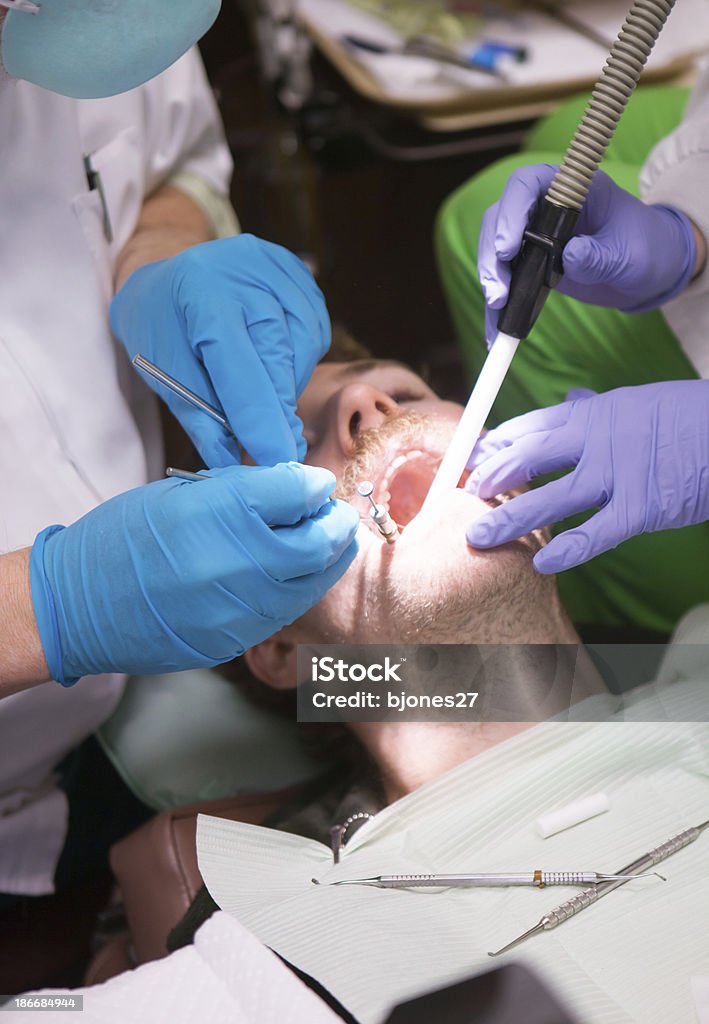 Hombre joven en de dentista con un relleno de diente - Foto de stock de Adulto libre de derechos