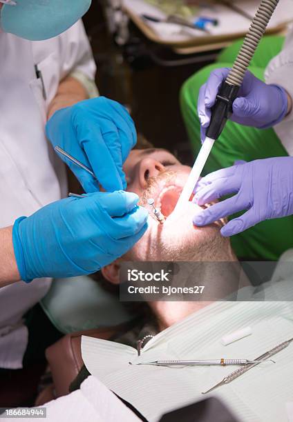 Jovem No Dentista Com Um Dente Cheia De - Fotografias de stock e mais imagens de Adulto - Adulto, Avental, Boca Humana