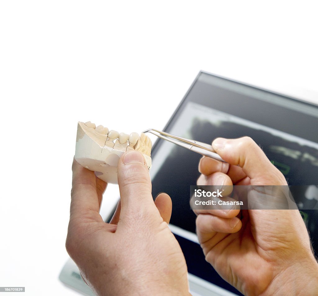 Dentiste examiner la moulure de la mâchoire. - Photo de Artificiel libre de droits