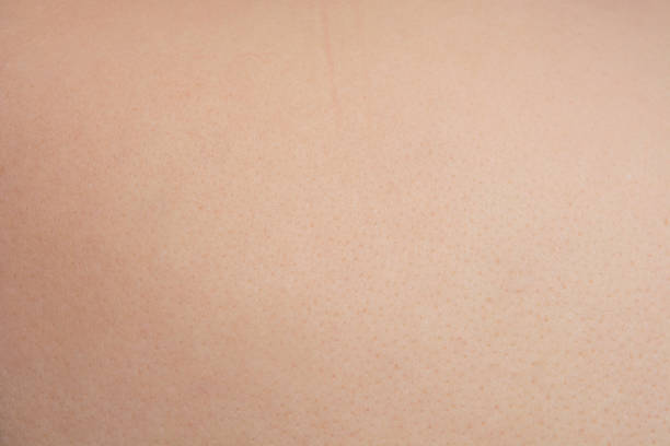 istock Caucasian Healthy human skin surface texture 1867256034