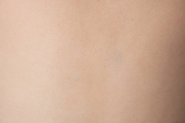 istock Caucasian Healthy human skin surface texture 1867256629