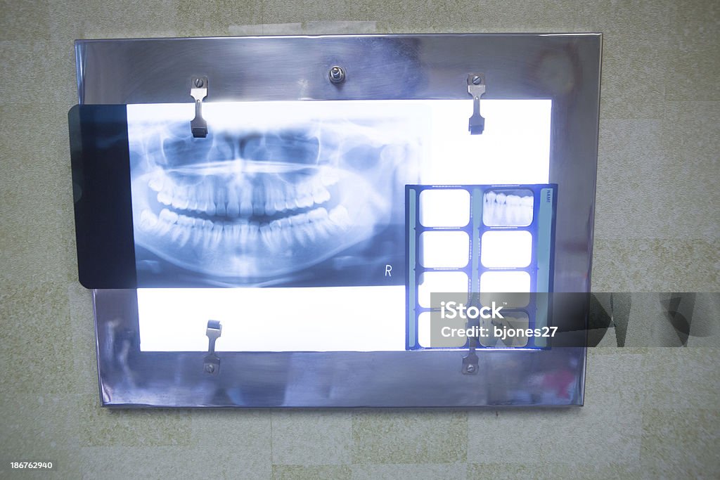 Sani di bocca Radiografia - Foto stock royalty-free di Ambulatorio dentistico