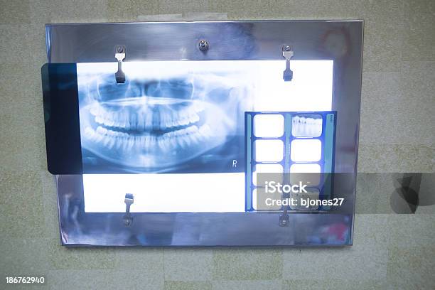 Sani Di Bocca Radiografia - Fotografie stock e altre immagini di Ambulatorio dentistico - Ambulatorio dentistico, Apparecchiatura odontoiatrica, Attrezzatura
