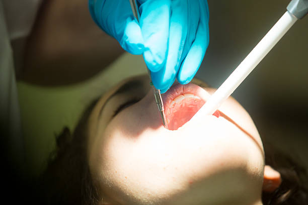 jovem mulher ficando um preenchimento - mouth open dental drill holding doctor - fotografias e filmes do acervo