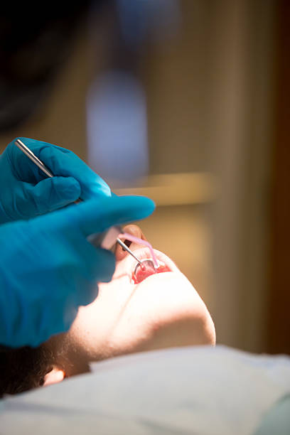 jovem mulher ficando um preenchimento - mouth open dental drill holding doctor - fotografias e filmes do acervo