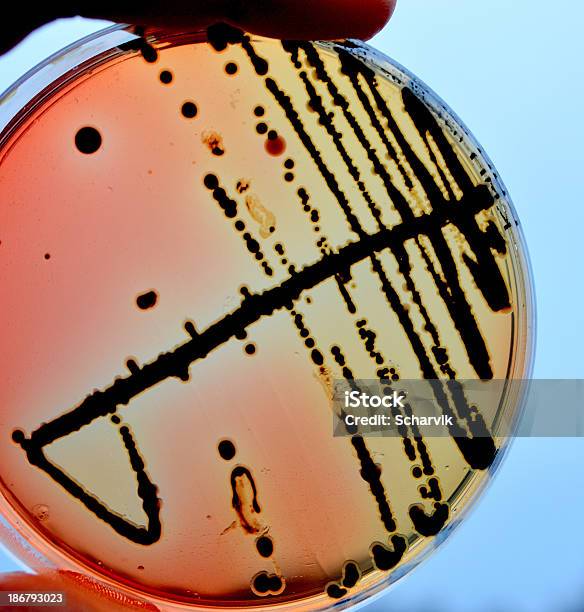 Photo libre de droit de Salmonella banque d'images et plus d'images libres de droit de Salmonelle - Salmonelle, Agent pathogène, Analyser