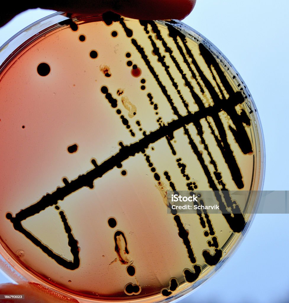 Salmonella - Foto de stock de Salmonela - Enterobactéria royalty-free