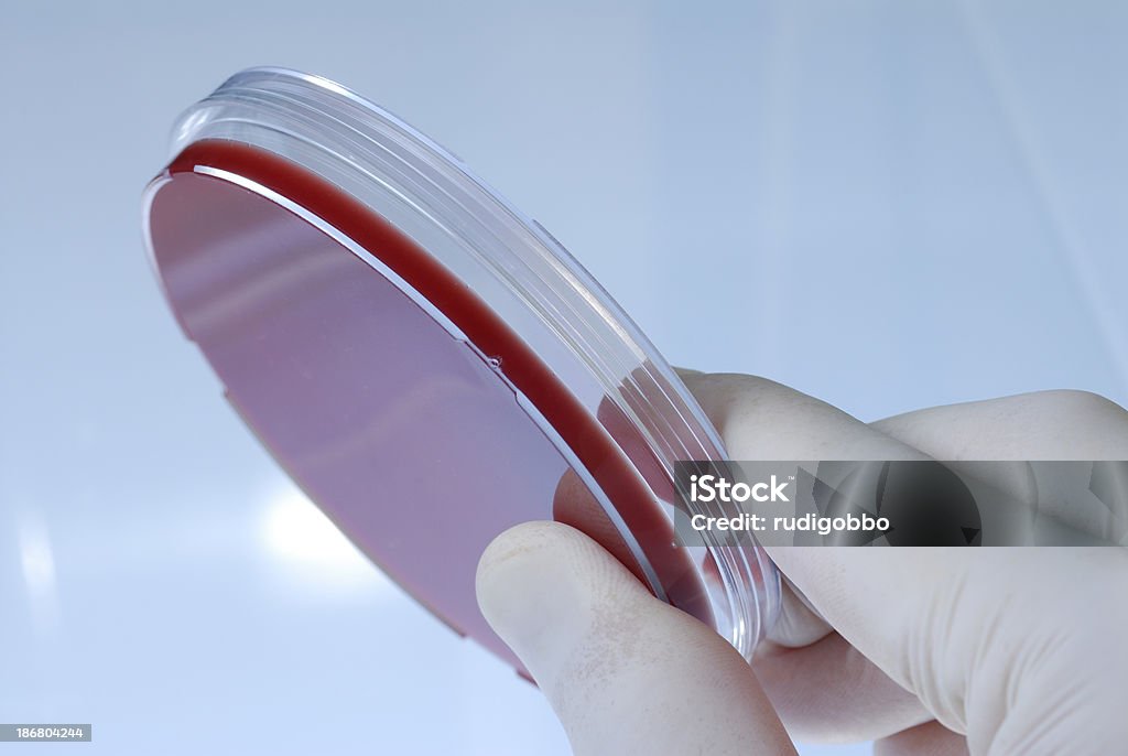 Gélose au sang assiette - Photo de Bactérie libre de droits