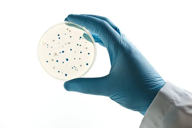 Photo of Scientist holding a Petri dish with bacterial clones