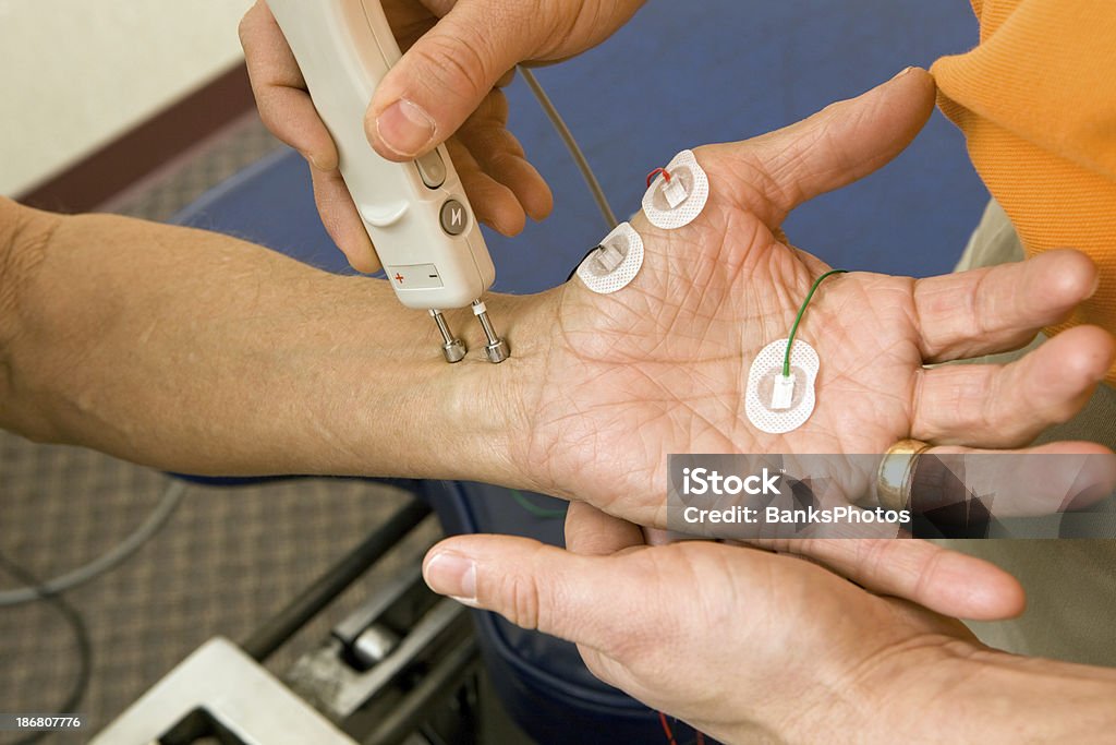 Chiropractor Performing a Median NCV (Nerve Conduction Velocity) Test  Human Nervous System Stock Photo