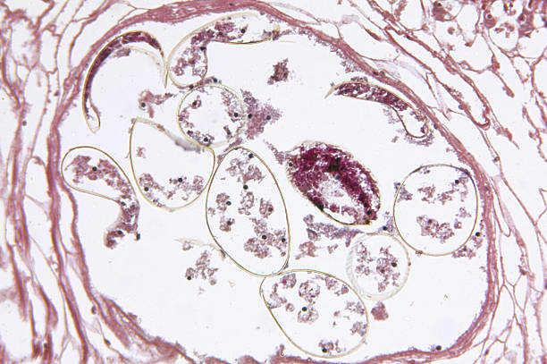 istock Fasciola Hepatica Liver Fluke Reproductive Regions TS 186809772