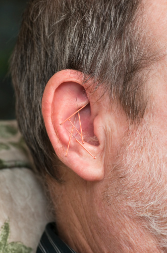 Closeup of acupuncture needles in a man's ear.Click below for my ACUPUNCTURE lightbox: