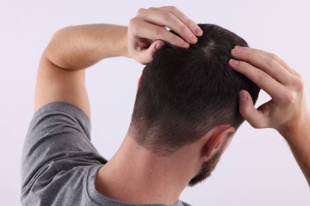 istock Man examining his hair and scalp on white background 1868173350