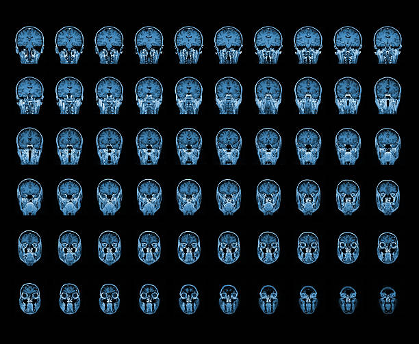 Human head on MRI scan stock photo